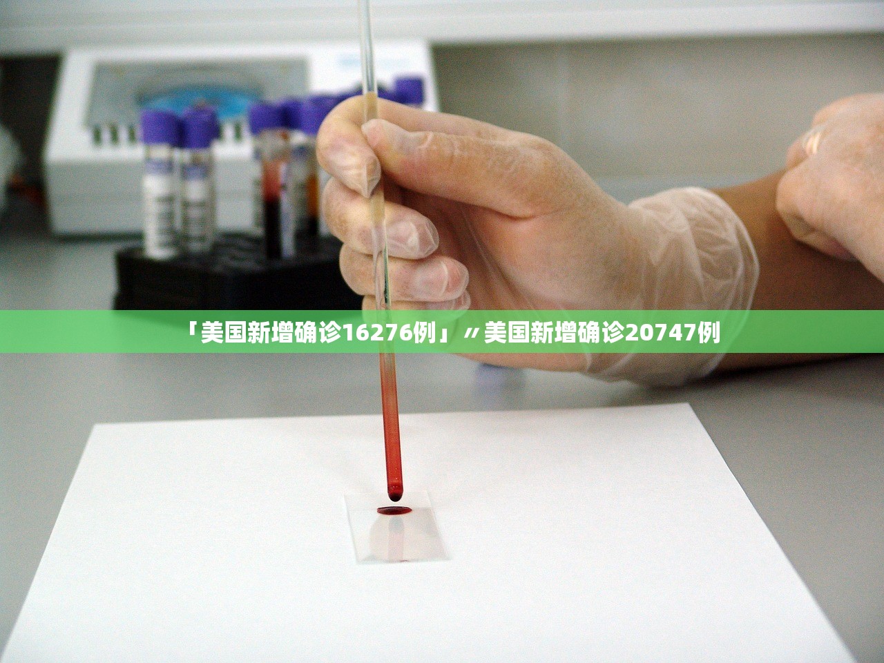 「美国新增确诊16276例」〃美国新增确诊20747例