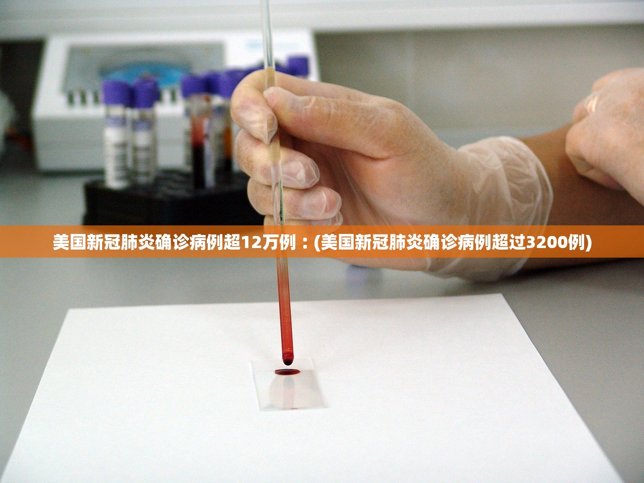 美国新冠肺炎确诊病例超12万例︰(美国新冠肺炎确诊病例超过3200例)
