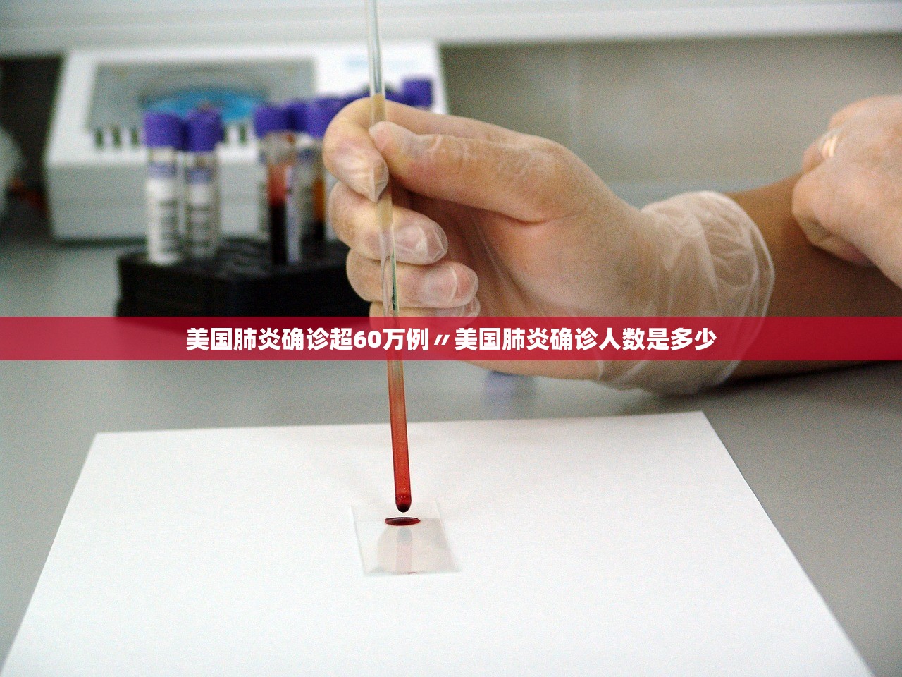 美国肺炎确诊超60万例〃美国肺炎确诊人数是多少